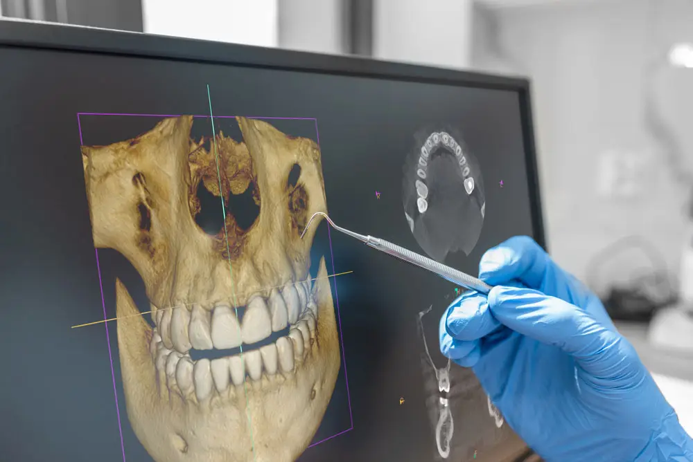 Dental X-Rays in Amarillo: Why They Matter Even When Your Teeth Feel Fine