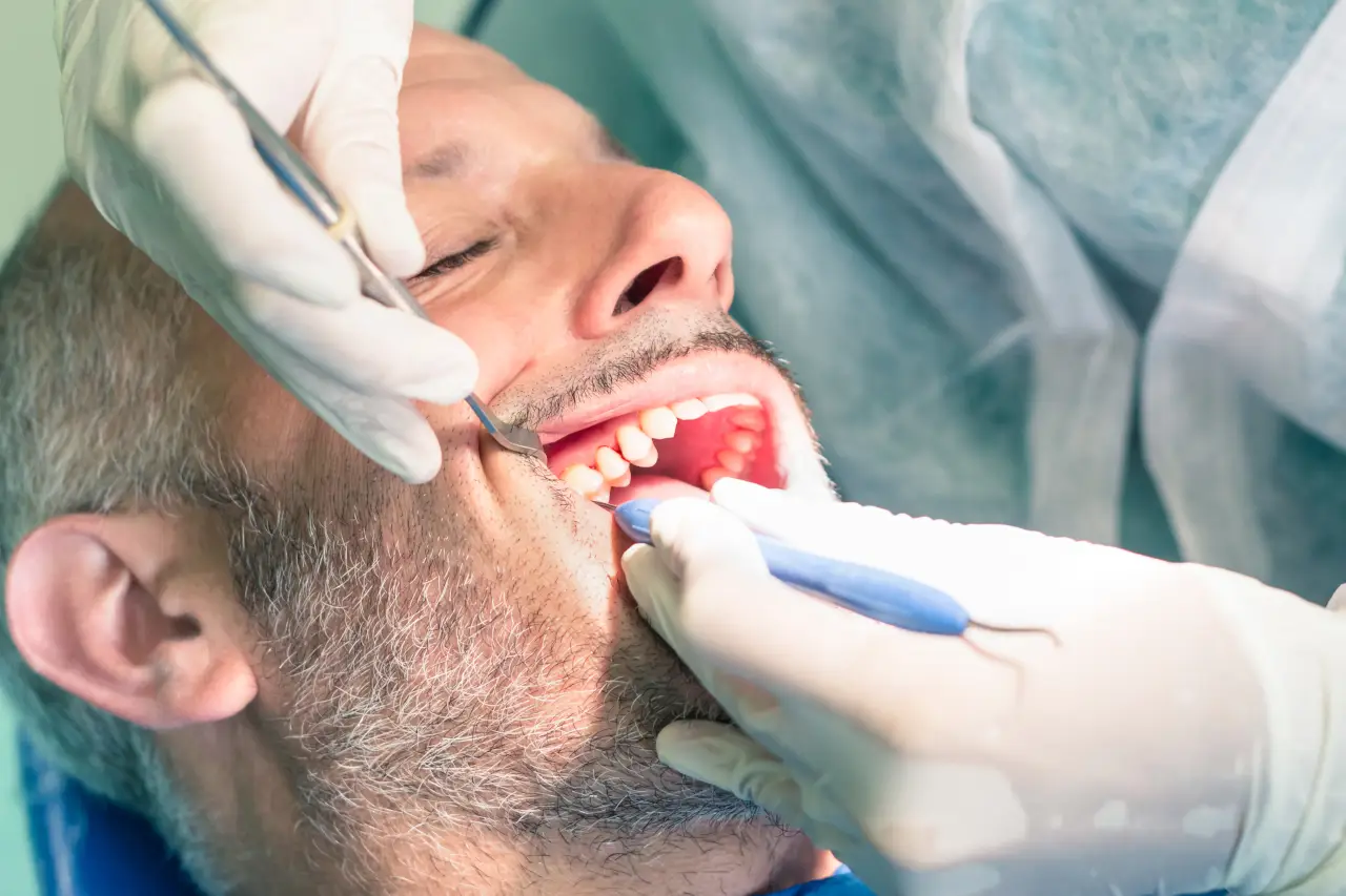 Oral Conscious Sedation in Amarillo: How to Prepare for a More Relaxed Dental Visit
